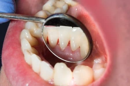 口腔健康