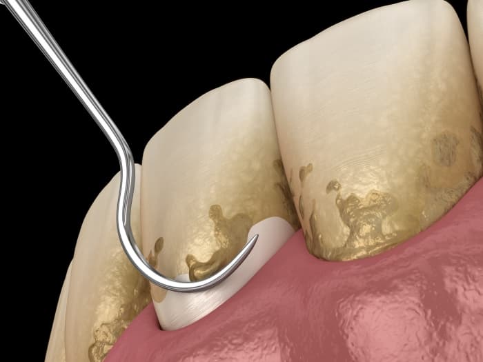 periodontology
