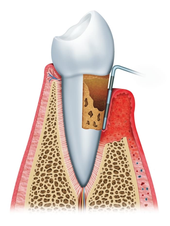 periodontology