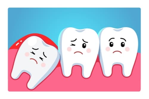 Is it necessary to remove the entire wisdom tooth? What you need to know about the wisdom tooth…
