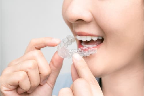Procedures and precautions for handling unfinished orthodontic treatment