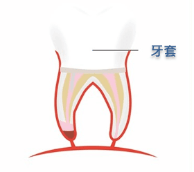 密封根管
