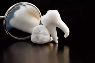 cost of extracting wisdom teeth