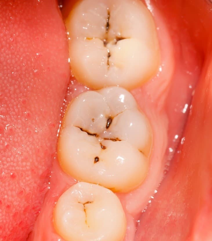 Breaking Down the 9 Common Causes of Pain in Cheekbones and Teeth
