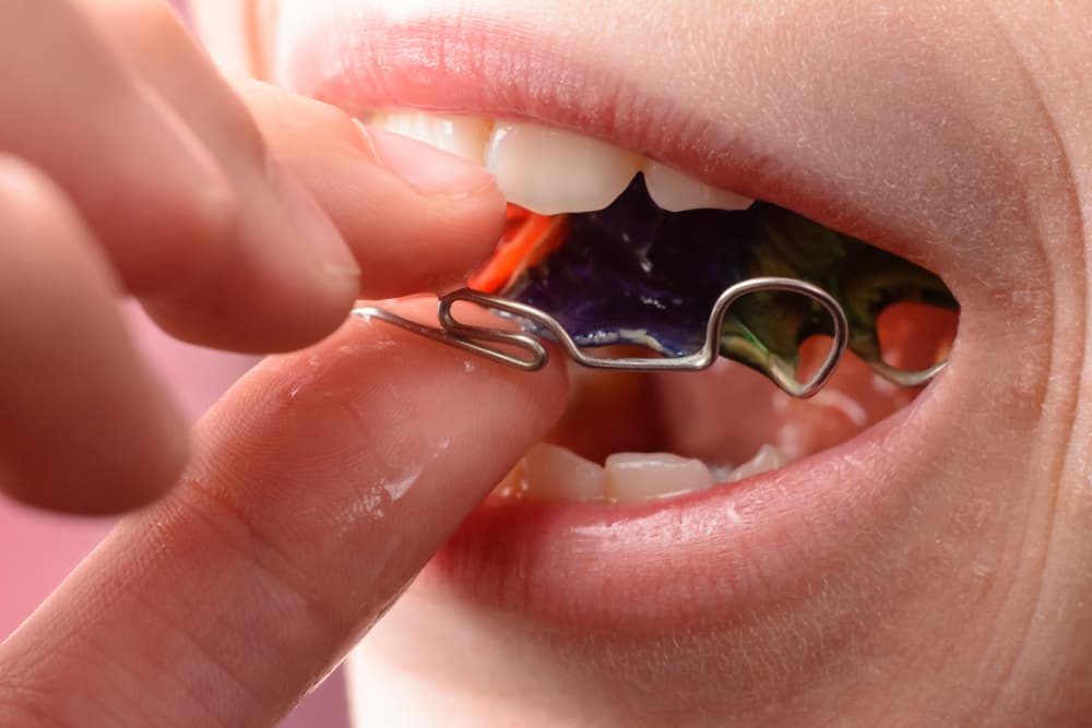 retainer in hong kong