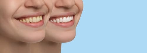 best interdental brush