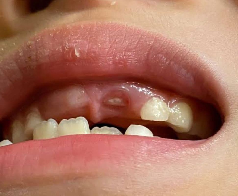  child change teeth sequence