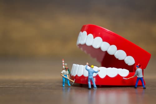 Miniature workers cleaning toy dentures, symbolizing the importance of regular dental cleaning.