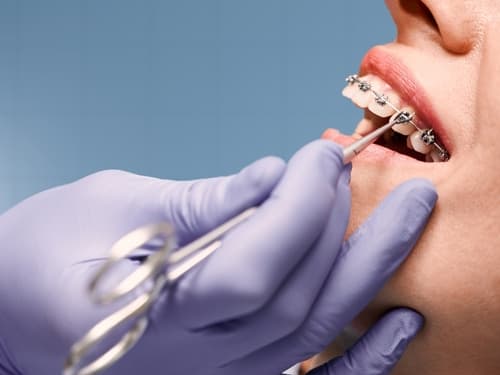 Dentist adjusting a patient’s traditional metal braces during a routine orthodontic appointment.