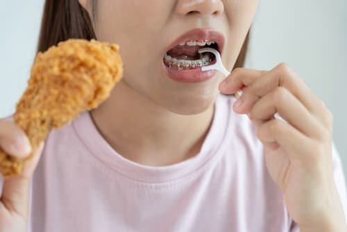 Woman with braces eating fried chicken, highlighting dietary challenges during orthodontic treatment.