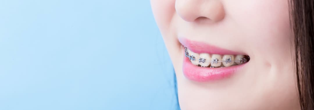 Rescue White Spotted Teeth