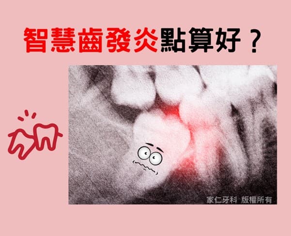 智慧齒發炎點算好?