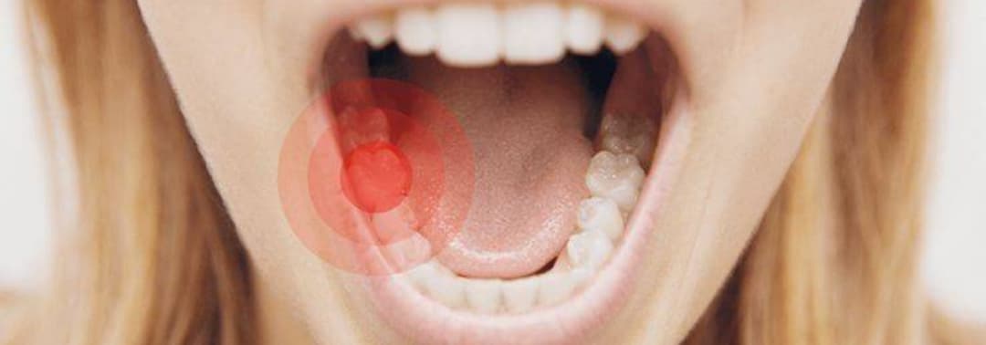 The Toothache First-Aid Guide: Six Fast Ways to Ease Pain Before You See a Dentist