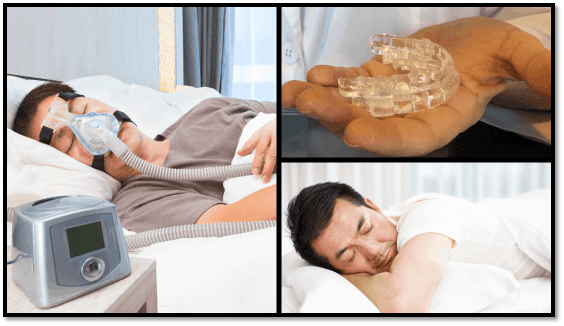 CPAP Isn't the Sole Option! Explore Dental Solutions to Improve Sleep Apnea